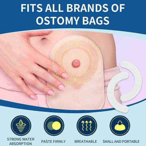 ovand (40pcs) Ostomy Barrier Strips - Ostomy Barrier Tape,Ostomy Supplies,Medical Grade Adhesive Barrier Strips Better