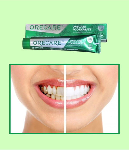 Whitening Toothpaste 100Gm, Powerful Whitening Without Sensitivity, Cavity Prevention (Pack 1)