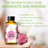 ROSE WATER TONER by Teak Naturals, 100% Organic Natural Moroccan Rosewater, Chemical Free, 4 oz
