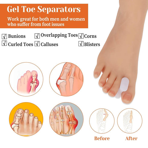 WY LIGHTING LEVEL 12Pcs Hammertoe (6L) Bunion Corrector Gel Toe Separators Soft Toe Spacers Overlapping Toes Pads Gel