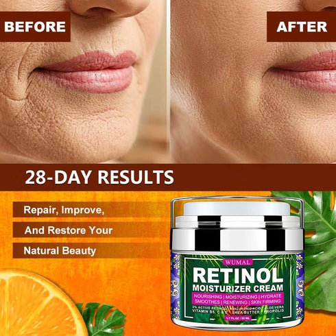 Retinol Cream - Reduces Wrinkles, Fine Lines, and Dryness, Face Moisturizer for All Skin Types, 1.7 oz