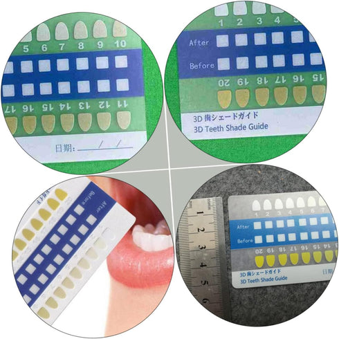 Ipetboom 20-Piece Set PVC Tooth Shade Comparison Chart Matte Finish Tooth Color Contrast Cards for Whitening Supplies