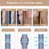 KISSLIFE 2 20-30 mmHg Pairs Compression Pantyhose Women Support Hose Closed Toe Graduated Compression Stockings