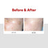 Medi-Peel Melanon X Cream 1.01 fl oz, Anti-Aging Spot Treatment, Brightening, Korean Skin Care
