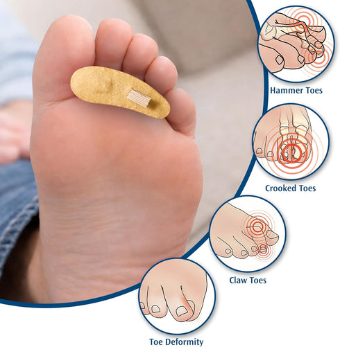 Hammer 3 Pack PediFix Felt Toe Crest Cushion with Loop Toe Support Pad for Callus Cushioning & Toe Tip Pressure Relief