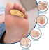 Hammer 3 Pack PediFix Felt Toe Crest Cushion with Loop Toe Support Pad for Callus Cushioning & Toe Tip Pressure Relief