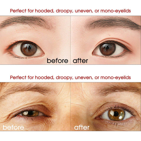 Ultra Invisible Double Eyelid Tapes, Medical Grade Latex Free, Instant Eye Lift, Hypoallergenic Fiber