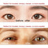 Ultra Invisible Double Eyelid Tapes, Medical Grade Latex Free, Instant Eye Lift, Hypoallergenic Fiber