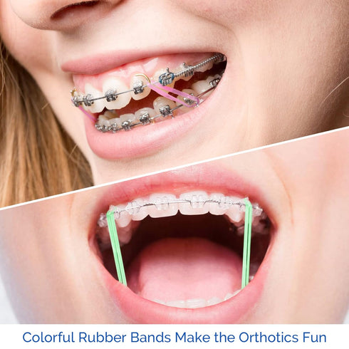 JMU Orthodontic Elastics 1/4 Medium, 500 Pack Non-Latex Intraoral Elastic Bands, Neon Dental Rubber Bands Made in USA