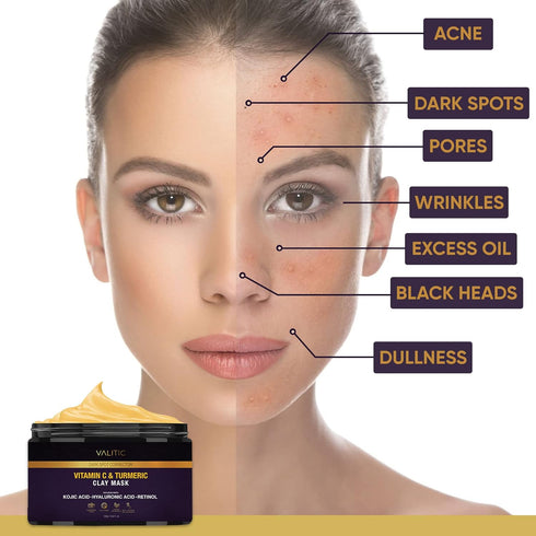 VALITIC Vitamin C & Turmeric Clay Mask, Dark Spot Corrector with Kojic Acid, 100g Skin Care Routine
