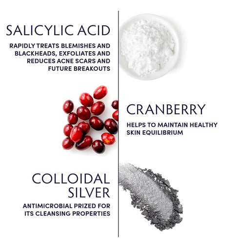 Naturopathica Colloidal Silver and Salicylic Acid Acne Clearing Cleanser, 5 fl oz Face Wash
