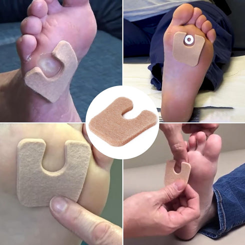 MoyRetty 60pcs U-Shaped Felt Callus Pads, Metatarsal Pads Self-Stick Cushions Protect Calluses from Rubbing on Shoes
