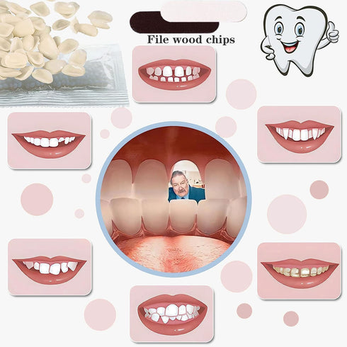 VEZE Tooth Repair Kit, Thermal Fitting Beads and Fake Teeth for Temporary Fixing Missing Tooth, Yellow