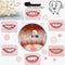 VEZE Tooth Repair Kit, Thermal Fitting Beads and Fake Teeth for Temporary Fixing Missing Tooth, Yellow