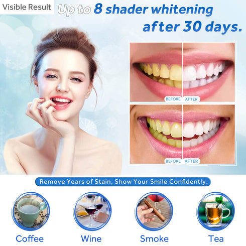 EZGO 10 Pack Teeth Whitening Gel Refills - 22% Bleaching Gel, No Sensitive Teeth Whitener, Carbamide Peroxide Teeth
