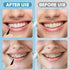 120 Pieces Braces Flossers, 360° Bendable Oral Dental Hygiene Tool, Toothpick Dental Flossing with Soft Bristles