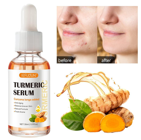 Turmeric Serum for Dark Spots, 1 Fl Oz, Anti Aging Facial Serum for Face & Body, Reduces Hyperpigmentation