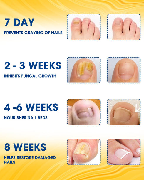 Nail Repair Patches Extra Strength, 28 Count for Damaged Nails, Nighttime Renewal Patches