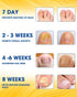 Nail Repair Patches Extra Strength, 28 Count for Damaged Nails, Nighttime Renewal Patches
