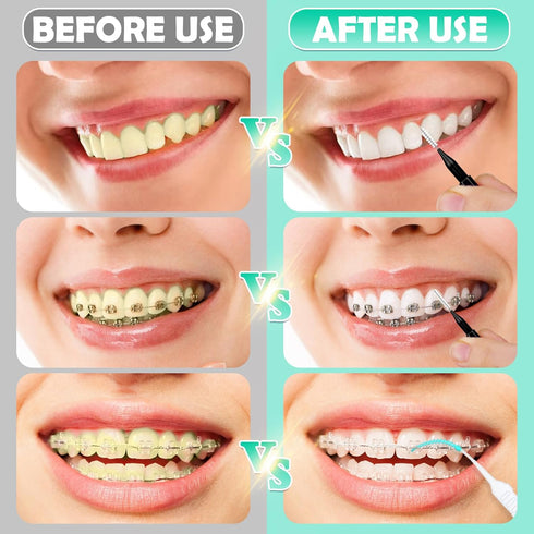 200 PCS Interdental Brushes, Dental Braces Floss Picks for Teeth Cleaning with Soft Bendable Bristles for Oral Care