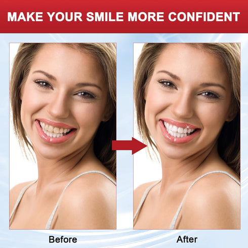 QIMHETU SP-8 SP8 (02) Probiotic Toothpaste, Toothpaste Fresh Breath, Deep Cleaning Care