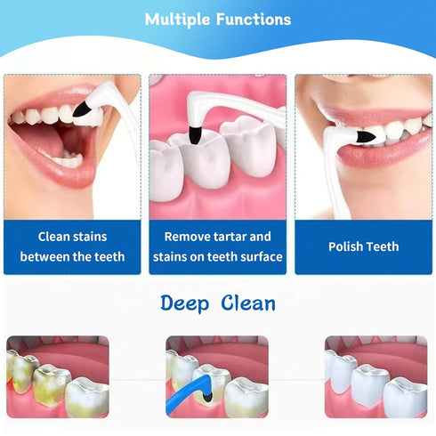 4-Pack Dental Tooth Stain Removers, Ergonomic Tools for Effective Plaque and Tartar Cleaning