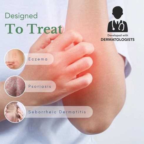 Theraplex AIM - Anti-Itch Moisturizing Cream (3 oz) - Non-stinging, Relieves Itching, Rashes, Flare Ups