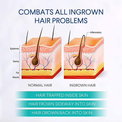 Razor Bumps Treatment for Women and Men, Ingrown Hair Serum for Bikini Area, Face, Neck, Legs, Underarm