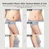 Tilbeble Fascia Massage Tool Blaster for CelluliteTrigger Points Massage ToolMuscle KnotsDeep Tissue Myofascial Release