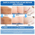 Niifawh Tape(1.6"x 120" Roll-3M) Clear Silicone Scar Sheets, Silicone Scar - Reusable, Soft & Medical Grade Adhesive