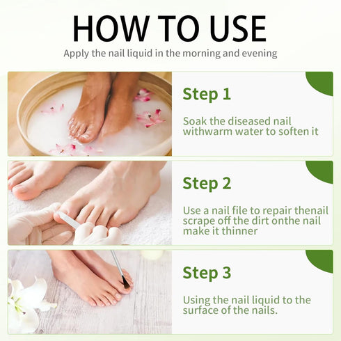 NOXYRAL 7 Toenail Fungus Treatment Extra Strength: Pure Natural Plant ExtractsToe & Fingernail Fungus Renewal - Nail