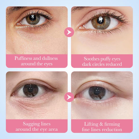 Sakura Eye Masks, 30 Pairs Collagen Gel Under Eye Patches, Moisturizing & Anti-Aging Skincare