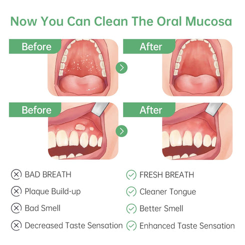 Oral Mucosal Cleaner | Silicon Oral Care Cleaner | Gum Massager with Air Bag (1 pc)