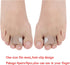 8 Pieces Toe Splint Wraps, Non Slip Hammer Toe Straightener for Broken, Crooked, Overlapped Toes - Women and Men