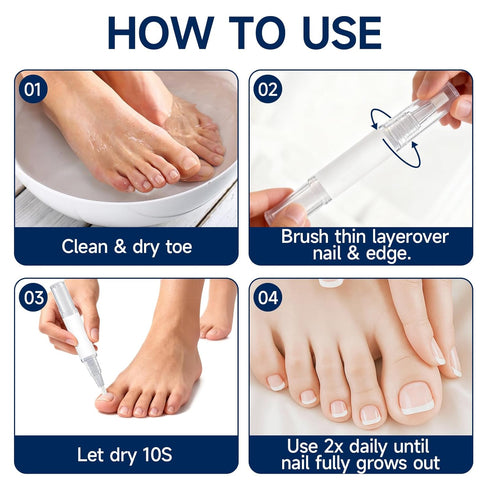 Nail Repair Pen with Lauric Acid and GlycerinStrengthens brittle nails, providing cooling relief for toenails