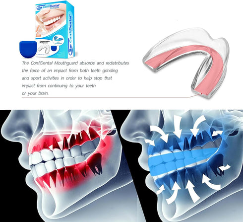 Pack of 4 Moldable Mouth Guard for Teeth Grinding, 2 Regular and 2 Heavy Duty Guard