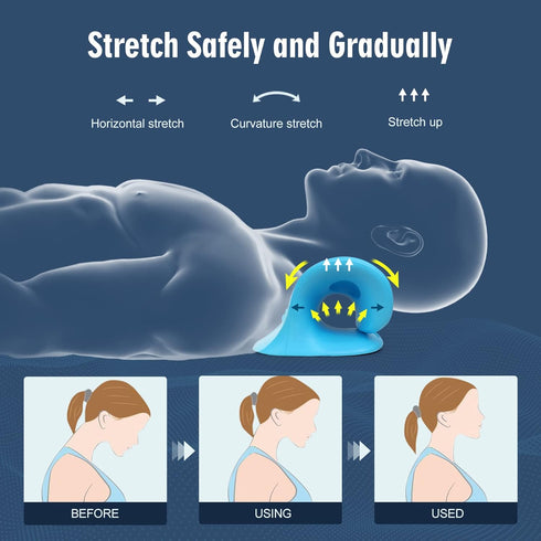 Neck Stretcher for Pain Relief, Cervical Traction Device Pillow for Muscle Relaxation and TMJ Pain Relief (Blue)