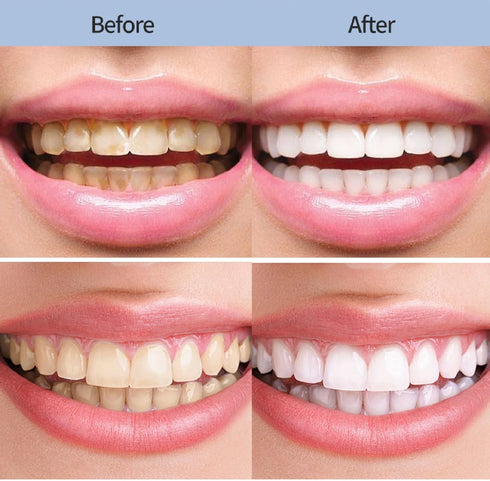 2Pcs Niacinamide Whitening Toothpaste, Fresh Breath Toothpaste for Removing Tooth Stains