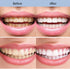 2Pcs Niacinamide Whitening Toothpaste, Fresh Breath Toothpaste for Removing Tooth Stains