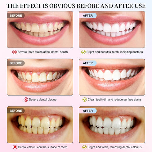 Mariayu Niacinamide Whitening Toothpaste, Niacinamide Toothpaste, Effectively Whitens Teeth, Protects Tooth Enamel