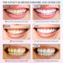 Mariayu Niacinamide Whitening Toothpaste, Niacinamide Toothpaste, Effectively Whitens Teeth, Protects Tooth Enamel