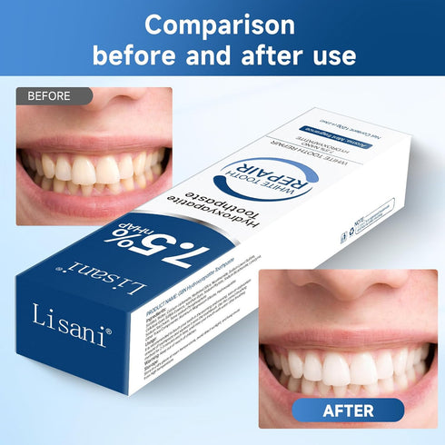 Set 2-Pack Hydroxyapatite Toothpaste for Teeth Remineralization, Enamel Repair, Sensitivity Relief & Whitening