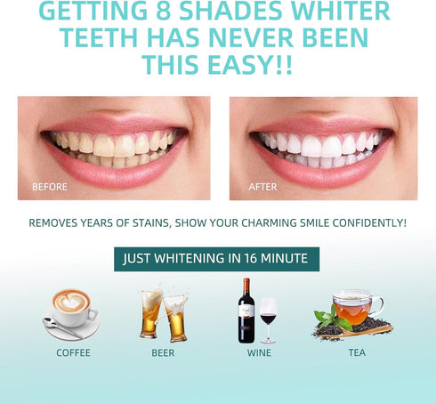 Teeth Whitening Kit with 32xLED Light, Professional Complete at Home Smart Phone Whitening System for iPhone/Android/USB