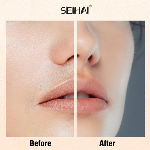 SEIHAI Facial Hair Removal Device for Women, Rechargeable Hair Remover for Face, Upper Lip, Chin, Includes 2