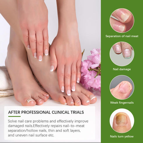 NOXYRAL 7 Toenail Fungus Treatment Extra Strength: Pure Natural Plant ExtractsToe & Fingernail Fungus Renewal - Nail