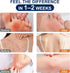 Kerova 2% (3.5 Antifungal Cream for Jock Itch, Athletes Foot & Ringworm - Miconazole Nitrate Cream for Humans Skin