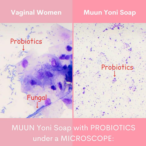 Pack 3 Muun Strawberry Yoni Soap Bar - pH Balancing Cleanser - Probiotics & Natural Ingredients - Gentle Cleansing