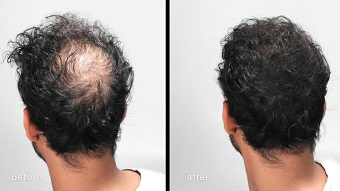 LUXE Hair Thickening Fibers - CONFIDENCE IN A JAR – Hypoallergenic, Dermatologist Tested – 2 Months+ Supply, Medium