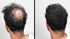 LUXE Hair Thickening Fibers - CONFIDENCE IN A JAR – Hypoallergenic, Dermatologist Tested – 2 Months+ Supply, Medium