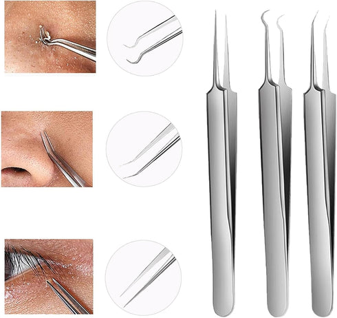 WSYUB Blackhead Tweezers, 3 in 1 Professional Stainless Skin Zit Acne Blemish Removing Tools Set